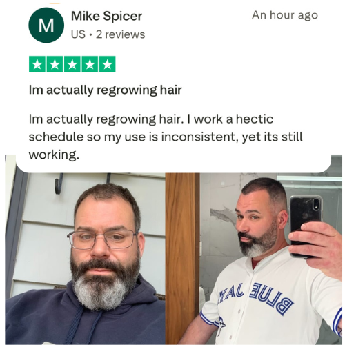 Copper Peptide Hair Regrowth Serum